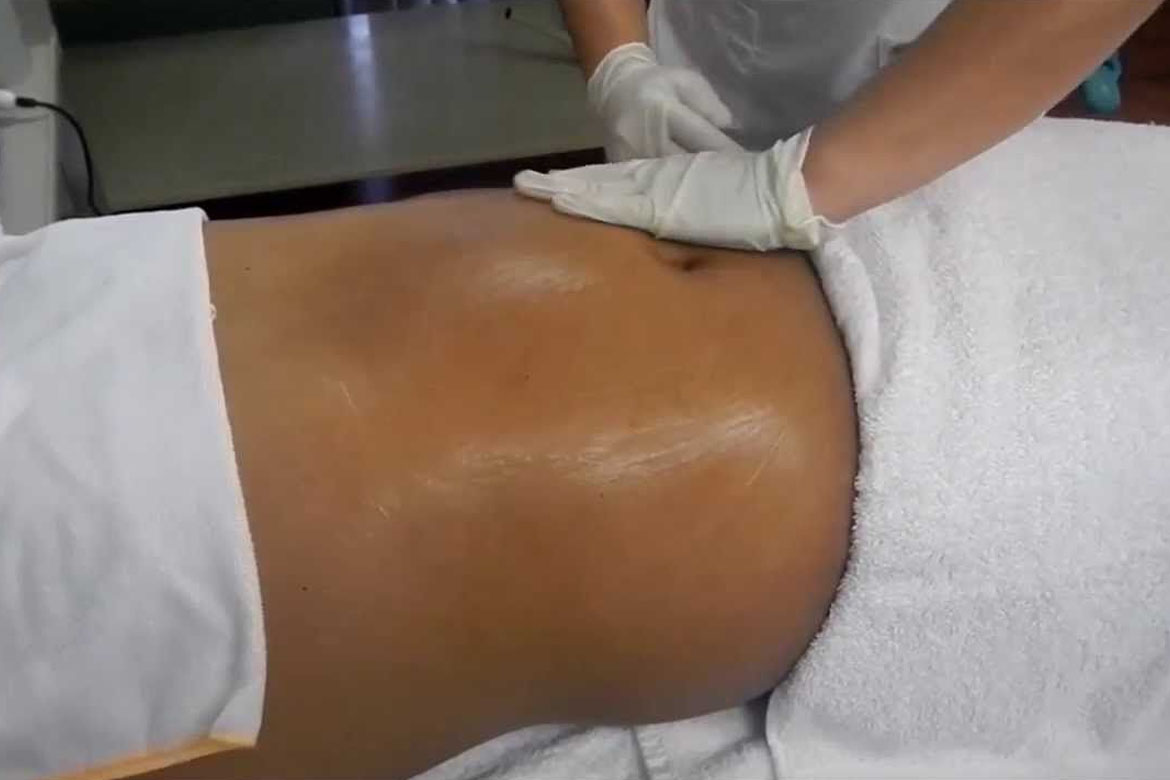 Drenaje Post operatorio en Kinesiologia ADn